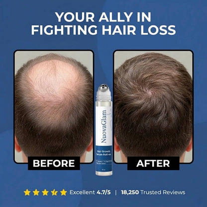 RootLift™ Hair Growth Roll-On Serum