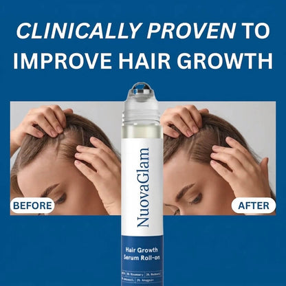 RootLift™ Hair Growth Roll-On Serum
