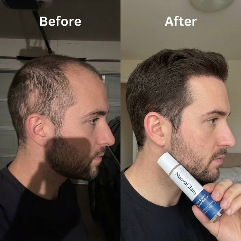 Before / after