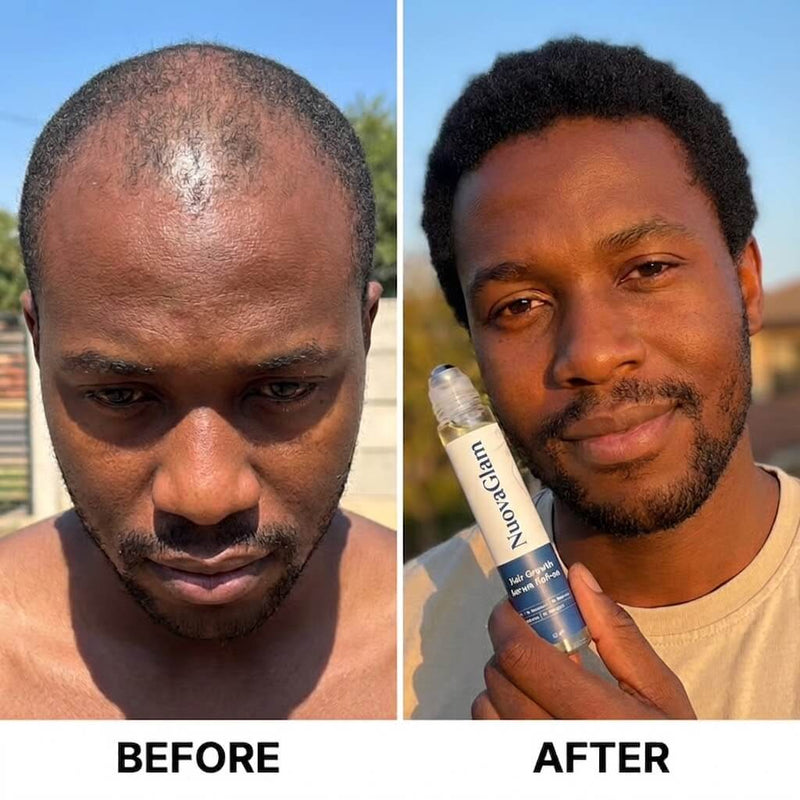 Before / after