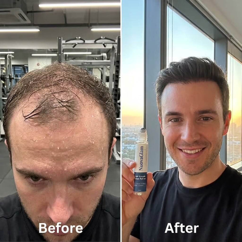 Before / after