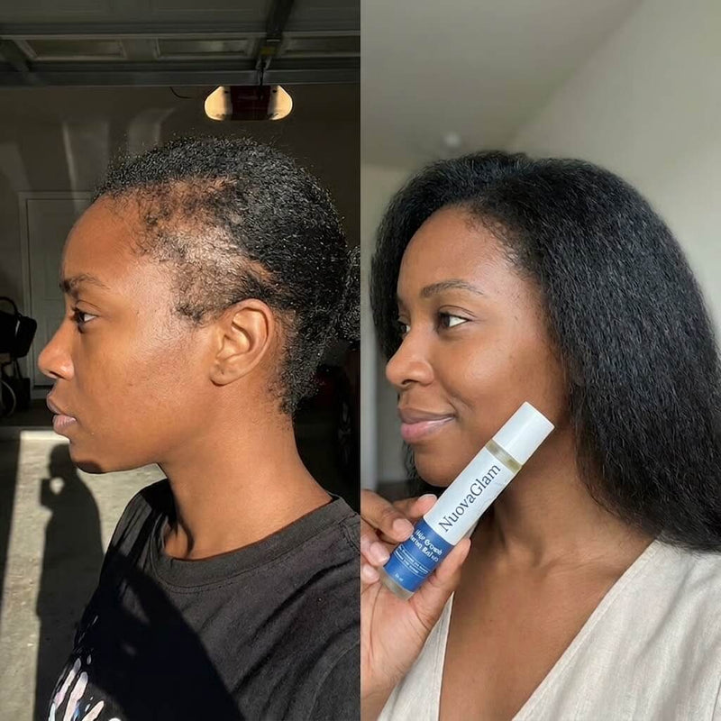 Before / after