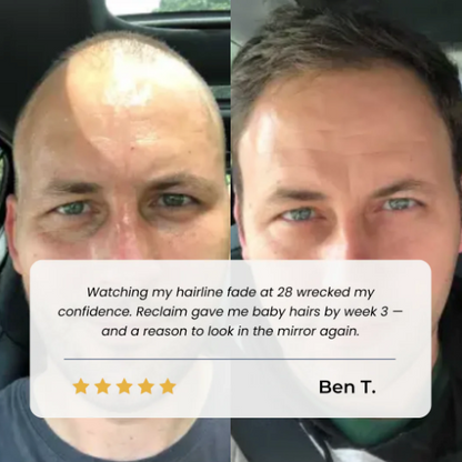 A REMPLACER (avis incruste citant une marque tierce) - before and after face